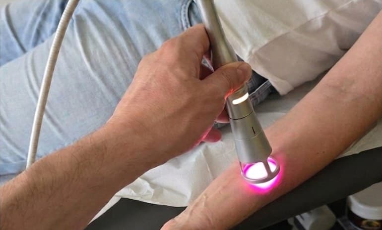 Il Dott. Montanaro esegue laserterapia sull'avambraccio di un paziente